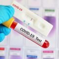 Tunggu Rekomendasi Kemenkes, RSUD Tarakan Siap Lakukan Diagnosa RT-PCR COVID-19
