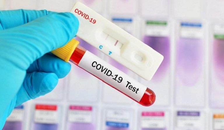 Rapid Tes PCR
